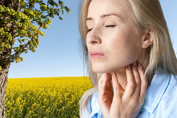 isla Allergie Moodshot